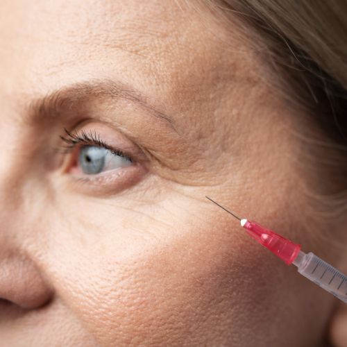 woman having a botox injection on the side of her eye