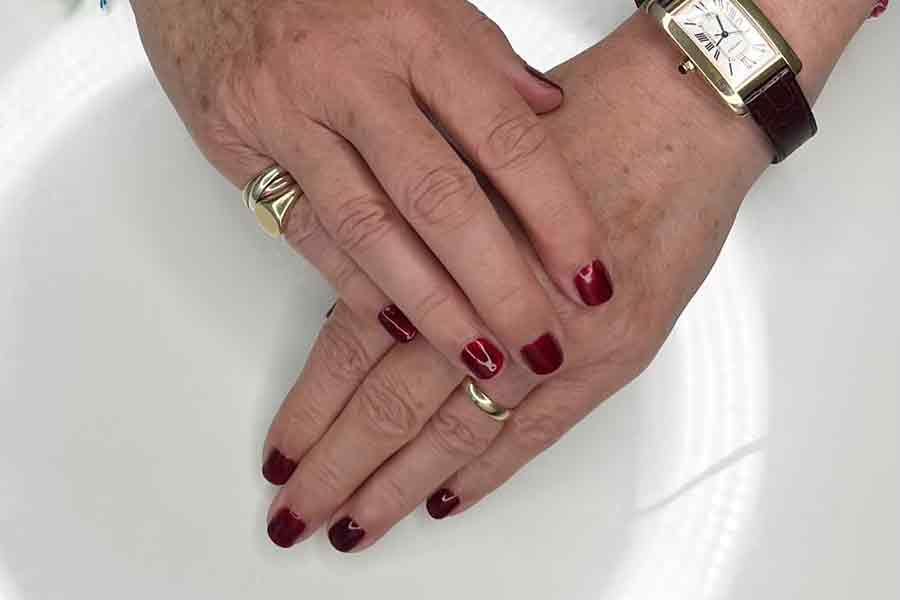 Woman recieving a hydration booster injection in her chin area